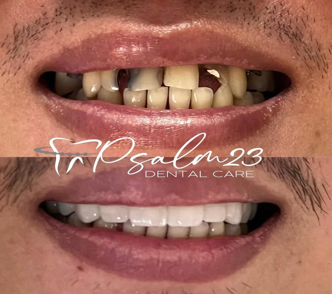 Psalm23 Dental Care cosmetic dentistry services — photo 6